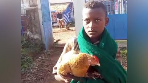 12‑Year‑Old Ethiopian Boy Wins Hearts by Bringing Chicken to Hospital