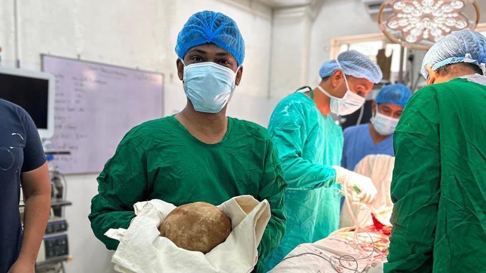 Sri Lankan Surgeons Extract 3.1‑kg Bladder Stone – Record‑Setting Surgery